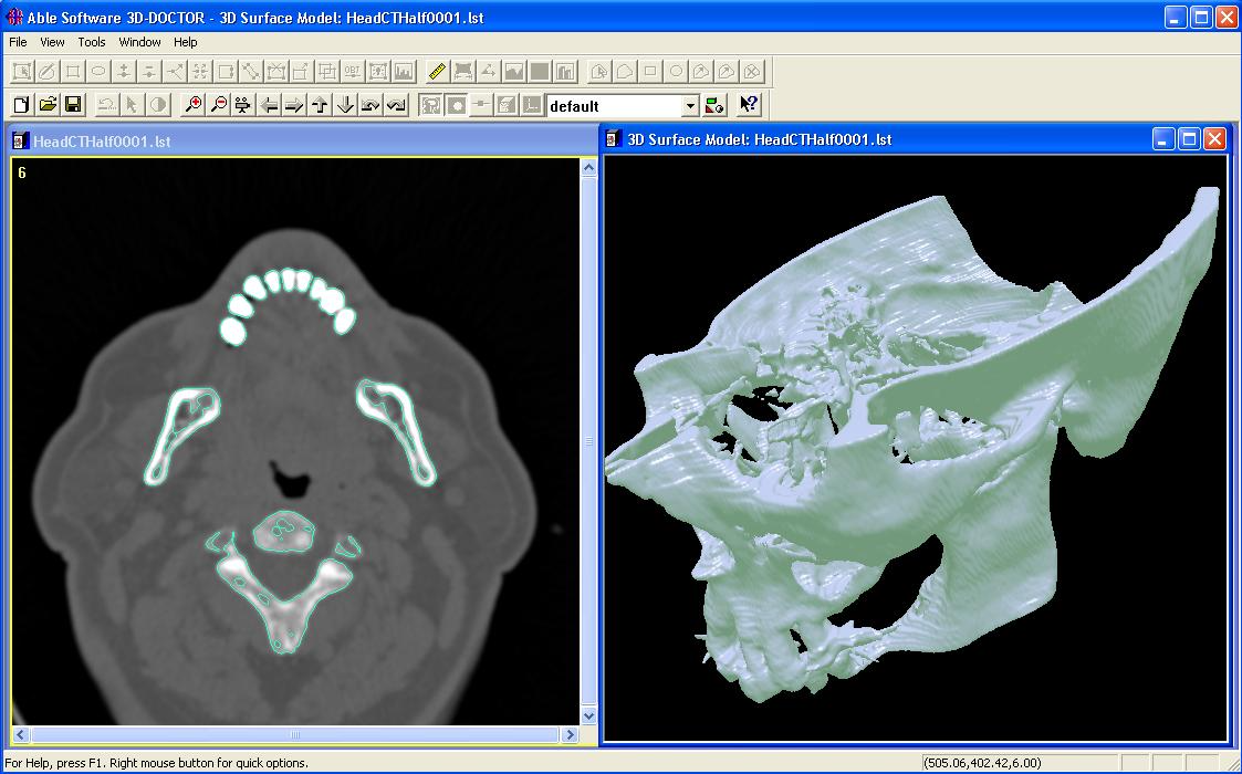 Dispositivos médicos em modelagem 3D